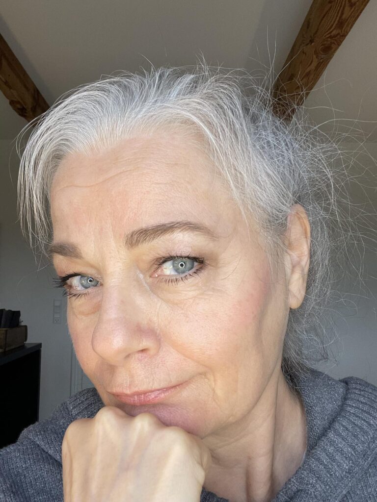 Pernille Højgaard med mange nye hår der vokser ud igen